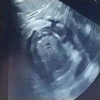 Bild "01ultraschall_500.jpg"